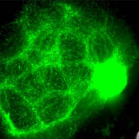 胶质瘤肿瘤细胞在有机体内生长。Corning®Matrigel®Matrix形成有机素发育的每个阶段的整体组分。图片由阿曼达博士提供礼貌。